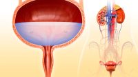 Proses Pembentukan Urine