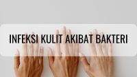 Infeksi kulit akibat bakteri