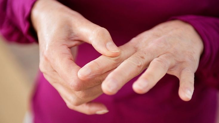 Penjelasan perbedaan rematik